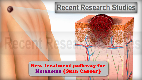New Research Gives hope for Skin Cancer Treatment