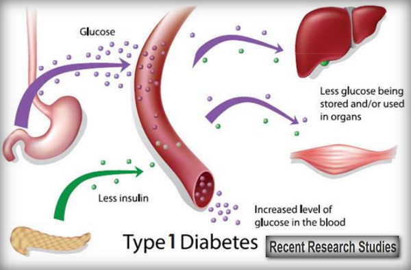diabetes type 1 treatment without insulin