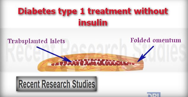 diabetes type 1 treatment without insulin