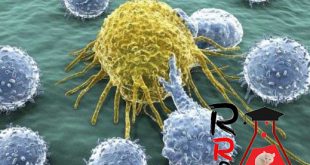 new prostate cancer treatment 100 effective by gold nanoparticles