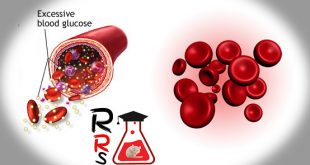 Diabetes Changes Red Blood Cells Morphology