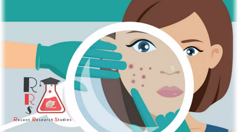 sometimes prescribed off-label for the treatment of hormonal acne